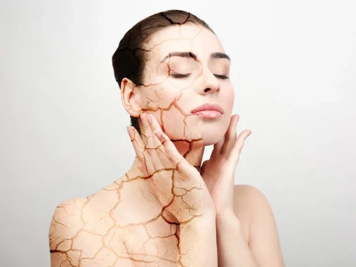Come combattere la pelle secca del viso? Ecco 7 ricette miracolose
