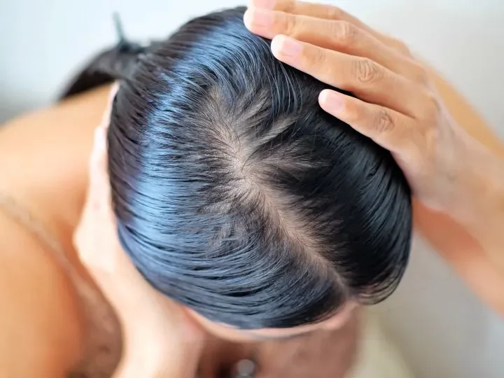 Eccesso di sebo: il miglior shampoo per capelli grassi